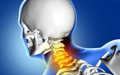 Spinal Stenosis in The Cervical Spine